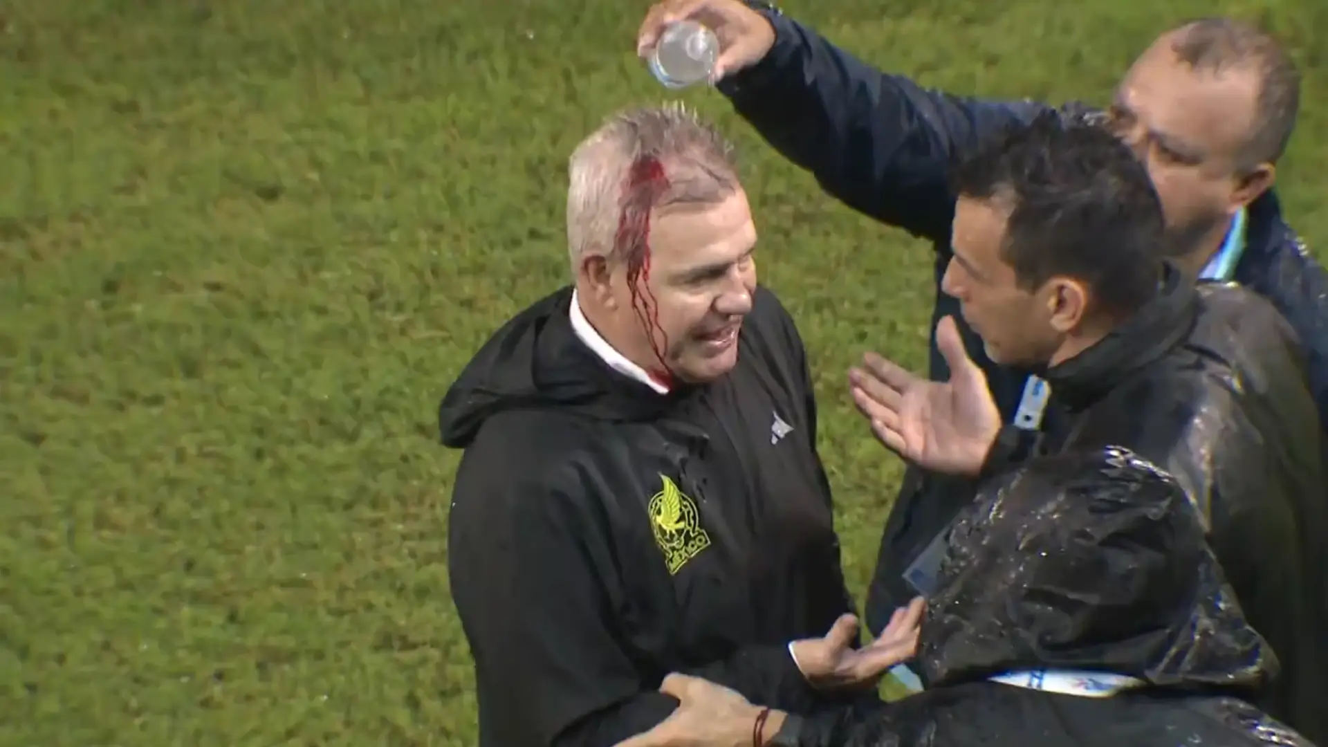 ‘It’s just football’ – Mexico coach Javier Aguirre defends Honduras fans who left him with bloodied head